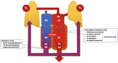 Pulmonary arterial hypertension related to congenital heart disease with a left-to-right shunt: phenotypic spectrum and approach to management